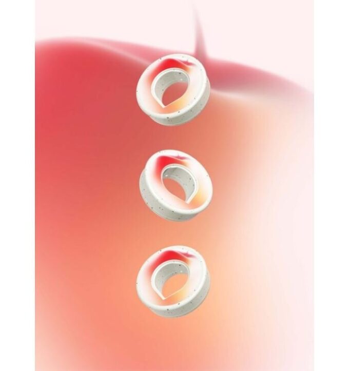 Æble-Pods